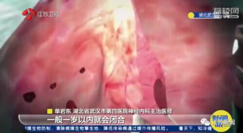 集中注意力头疼_头疼注意事项_头疼应该注意什么