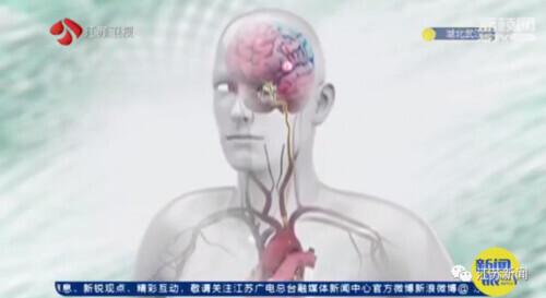 头疼注意事项_头疼应该注意什么_集中注意力头疼